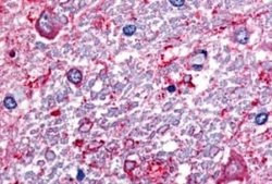 SLC5A3 Antibody, Novus Biologicals 50 &mu;g; Unconjugated:Antibodies, Polyclonal